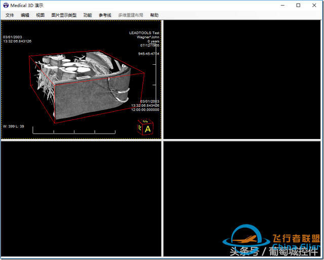LEADTOOLS醫(yī)學(xué)三維影像演示使用入門-7582