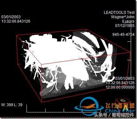 LEADTOOLS醫(yī)學(xué)三維影像演示使用入門-7039