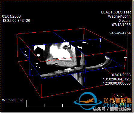 LEADTOOLS醫(yī)學(xué)三維影像演示使用入門-3578