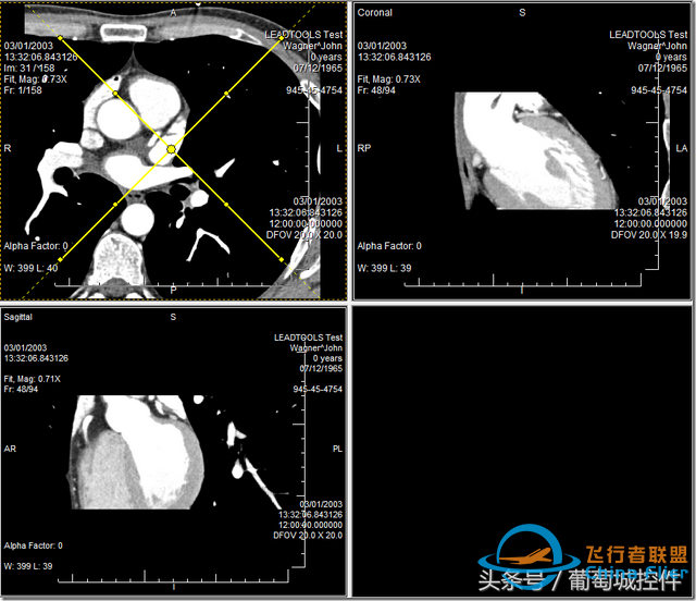 LEADTOOLS醫(yī)學(xué)三維影像演示使用入門-2718