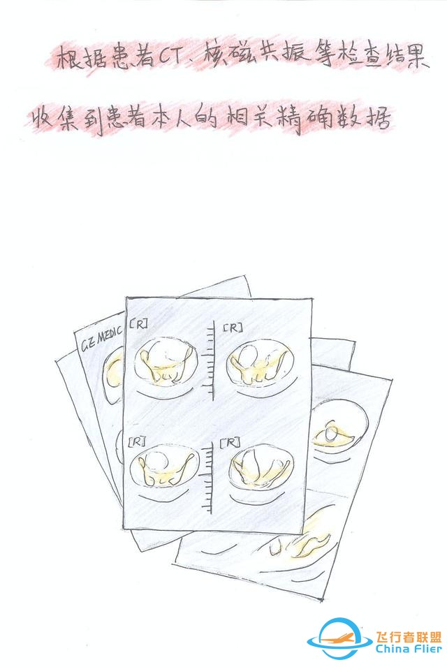 醫學領域的“AR 3D”技術究竟有多炫？10幅手繪漫畫給你講透-8775