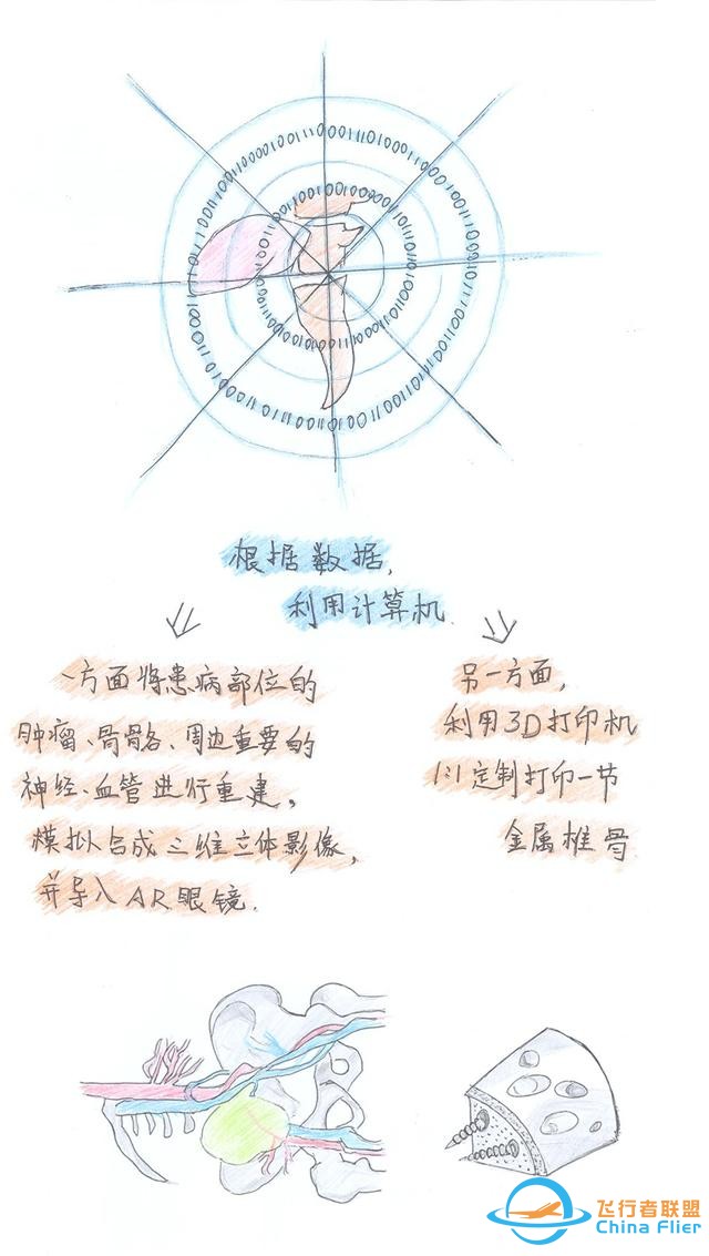 醫學領域的“AR 3D”技術究竟有多炫？10幅手繪漫畫給你講透-8117