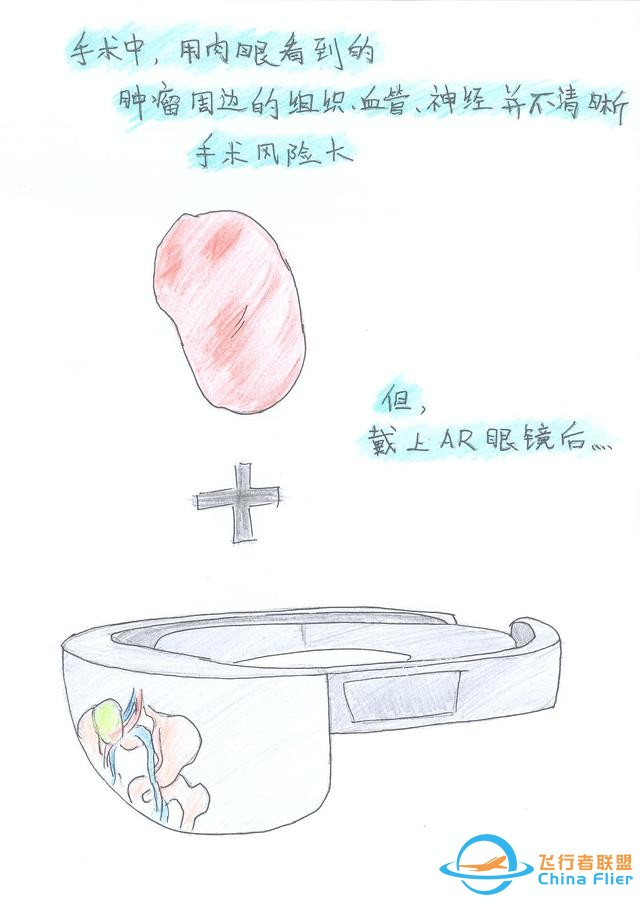 醫學領域的“AR 3D”技術究竟有多炫？10幅手繪漫畫給你講透-245