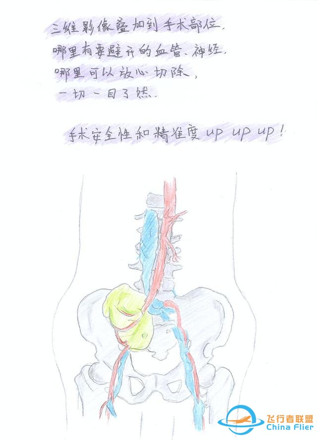 醫學領域的“AR 3D”技術究竟有多炫？10幅手繪漫畫給你講透-3343