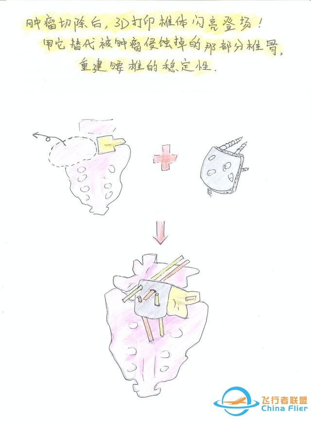 醫學領域的“AR 3D”技術究竟有多炫？10幅手繪漫畫給你講透-9058